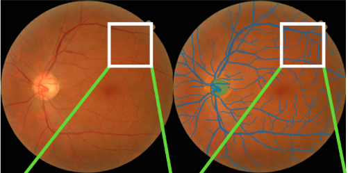 Artery/vein labelling overlaid on a fundus image