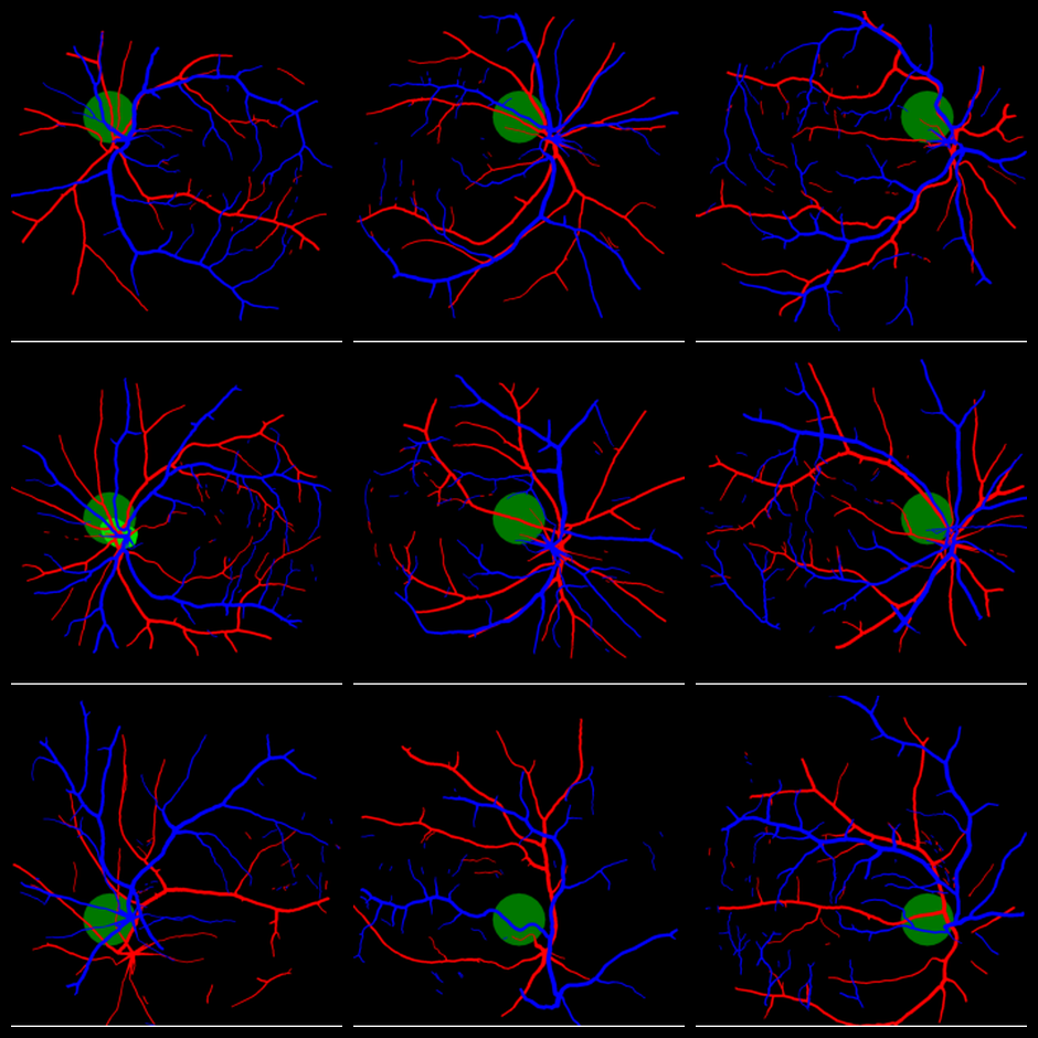 Controllable optic disc placement