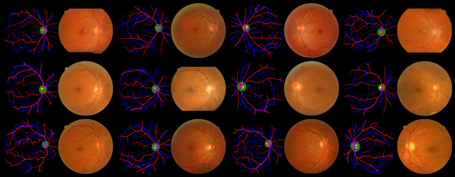Generated anatomy masks and fundus images